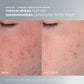 Daily Microfoliant