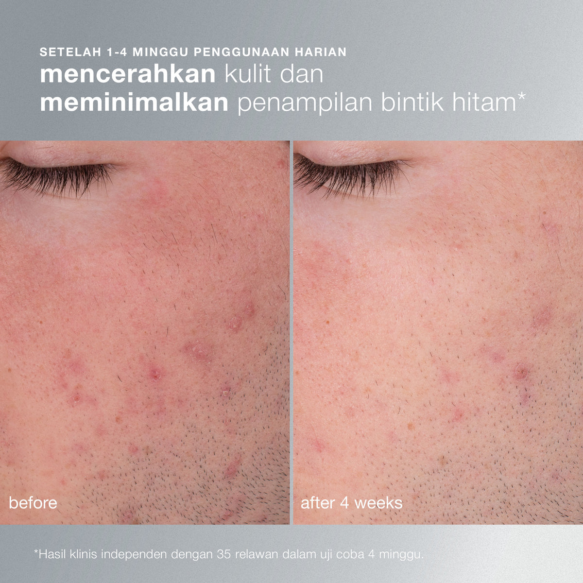 Daily Microfoliant
